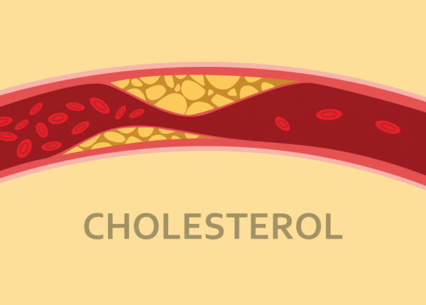 omega 3 giảm cholesterol
