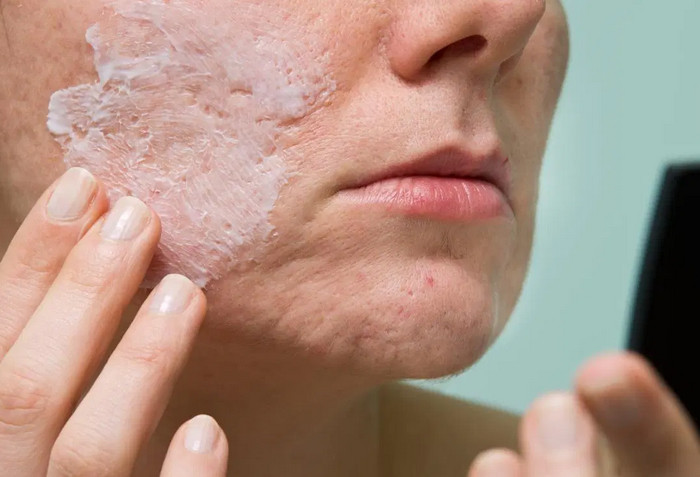Benzoyl Peroxide