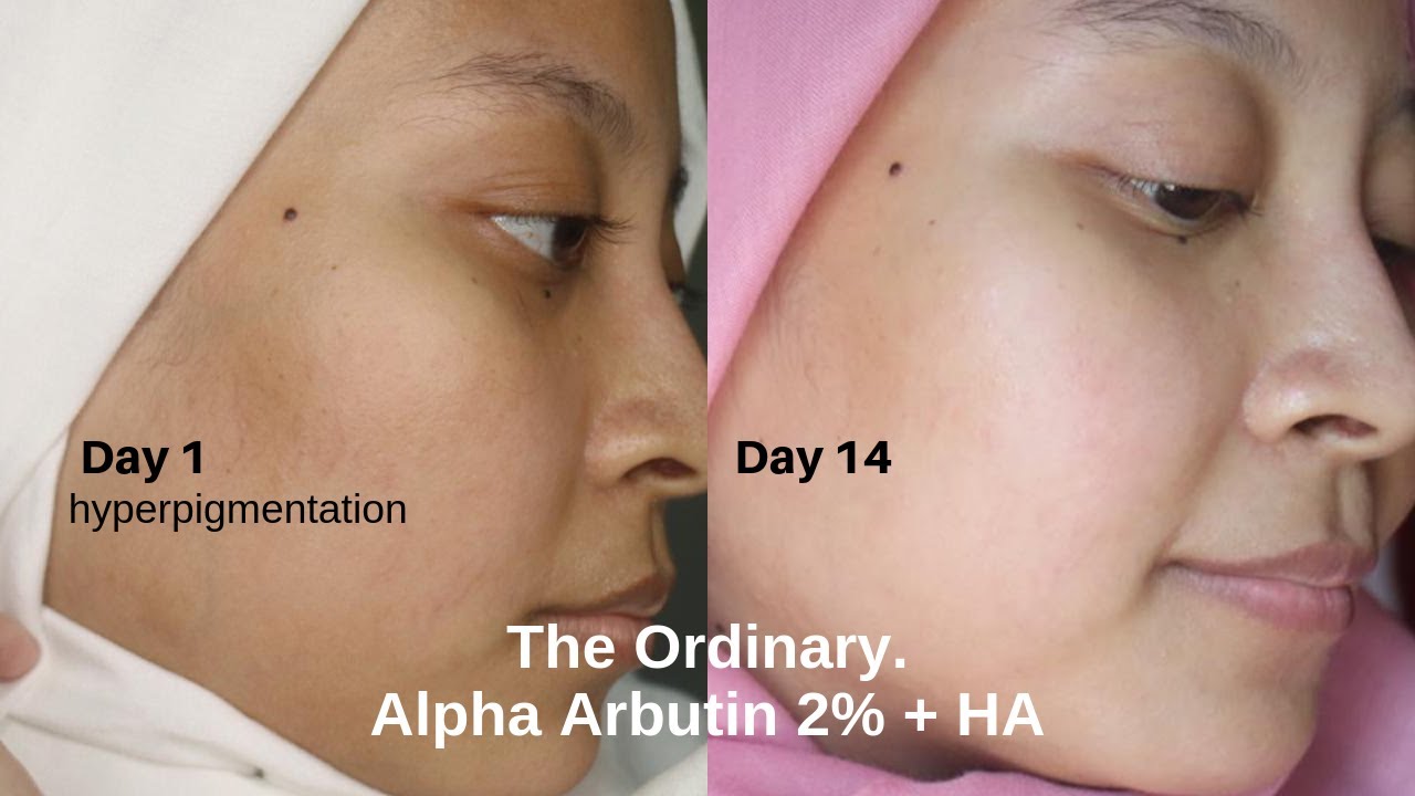 Arbutin alpha