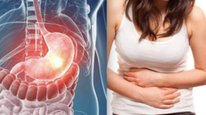loét dạ dày avt