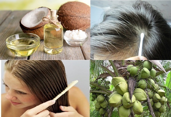Dầu dừa trị gàu