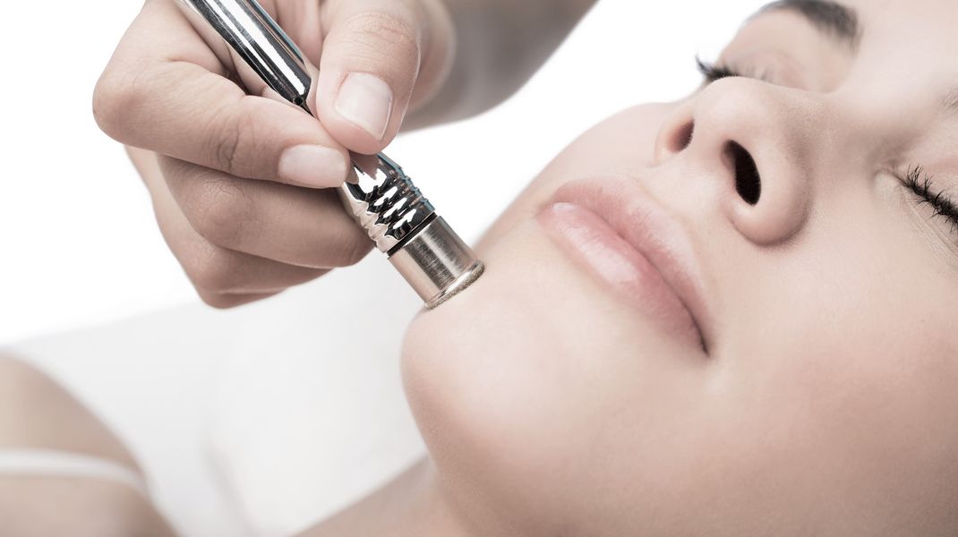Microdermabrasion