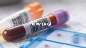 RDW là gì