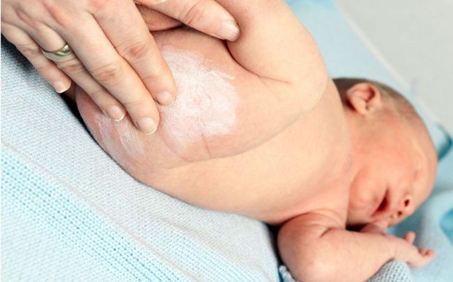 Sử dụng các sản phẩm ngăn ngừa hăm da cho trẻ