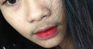 Vì sao ria mép mọc nhiều ở nữ