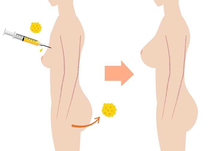 Xét về mức độ an toàn y khoa