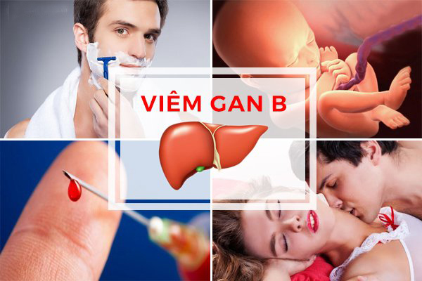 lây nhiễm qua đường nào