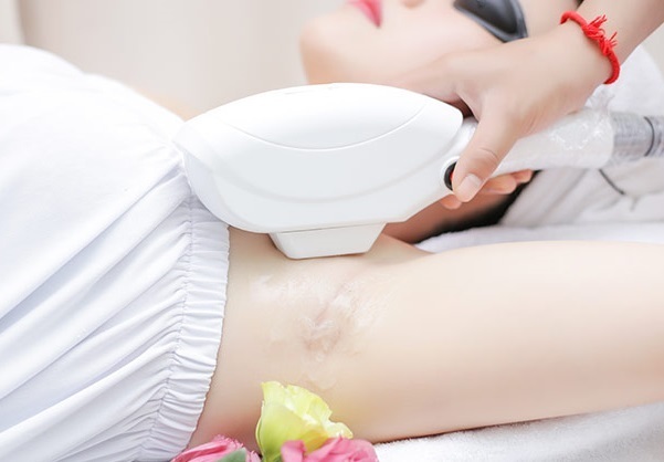 tẩy lông bằng laser