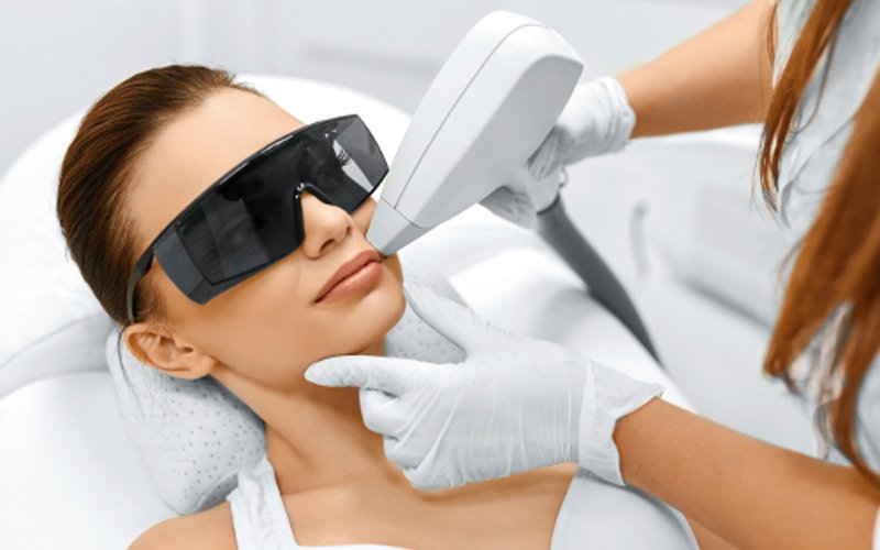 Tẩy lông bằng laser