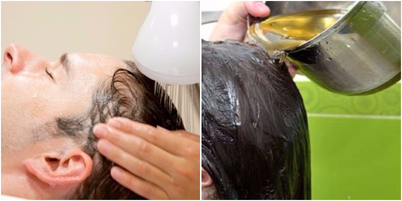 trị gàu bằng bia