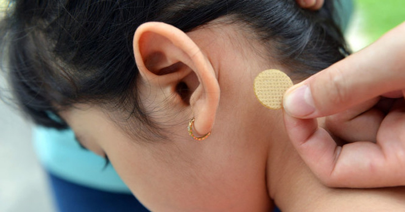 Miếng dán cổ tay và rốn