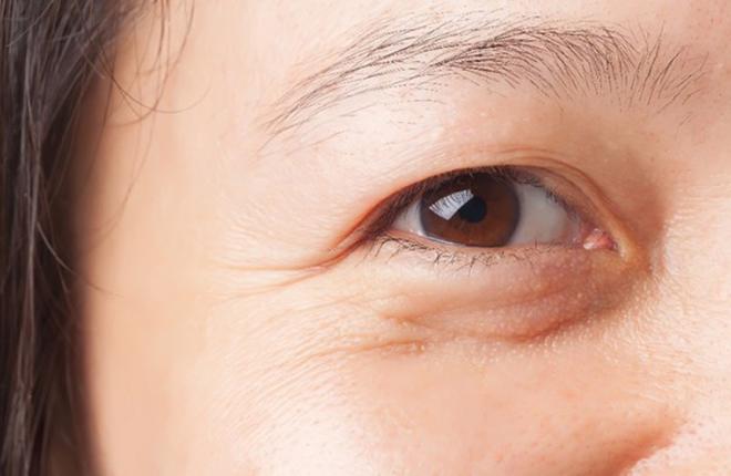 Vùng da quanh mắt