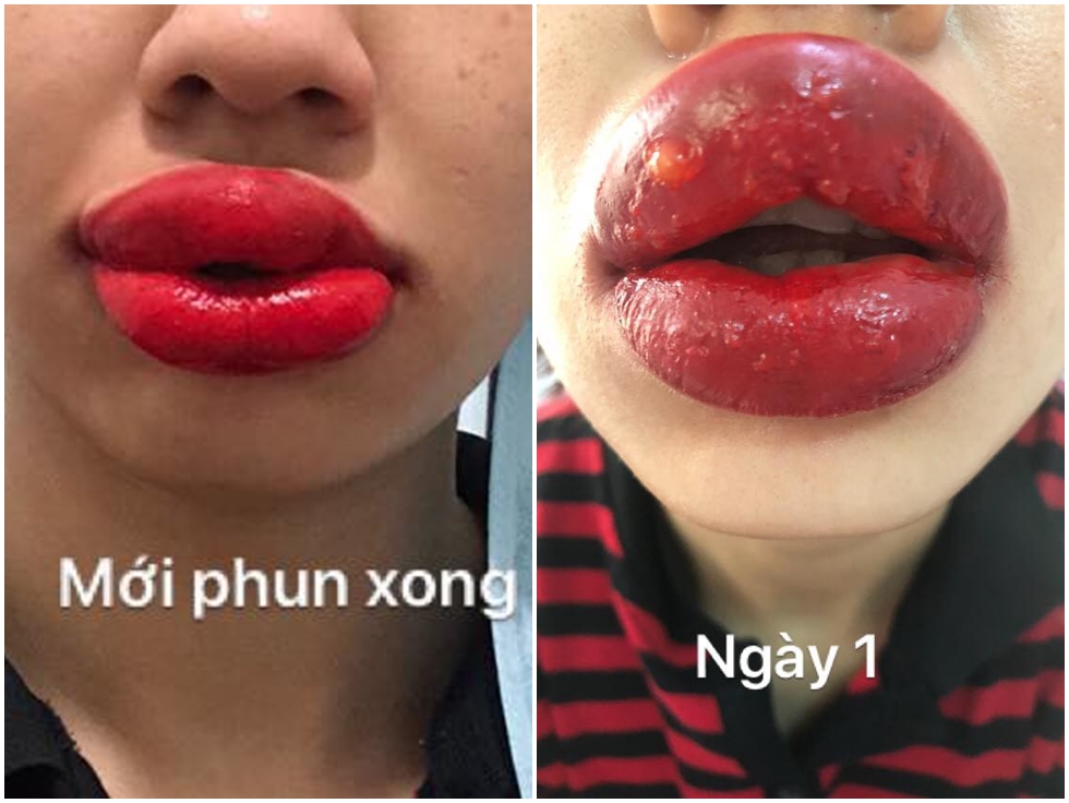 phum môi 2