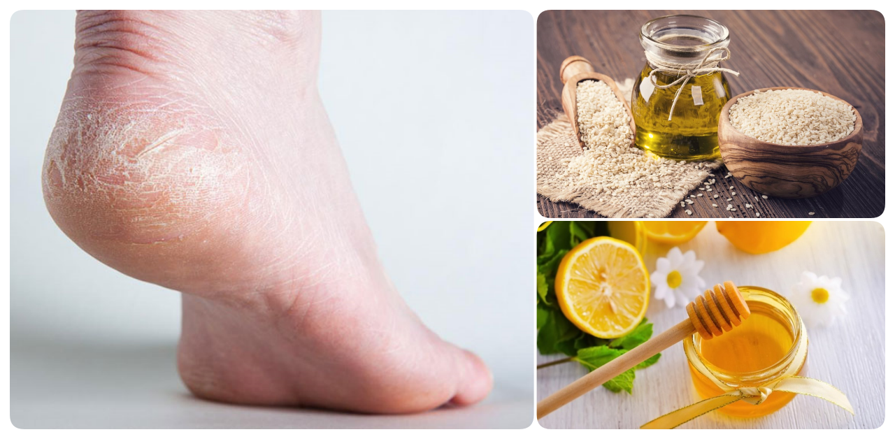 Bột gạo, mật ong và dấm