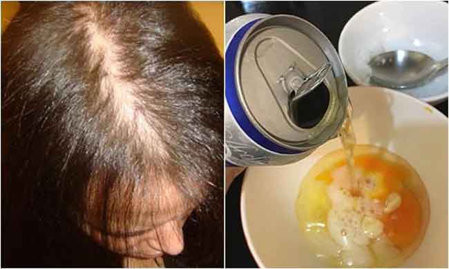 Cách ủ tóc bằng bia