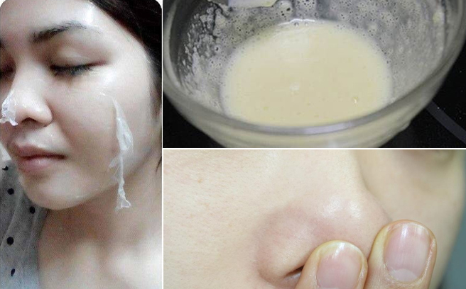 Mặt nạ lột mụn tự chế gelatin