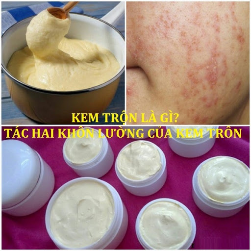 Những tác hại từ kem trộn