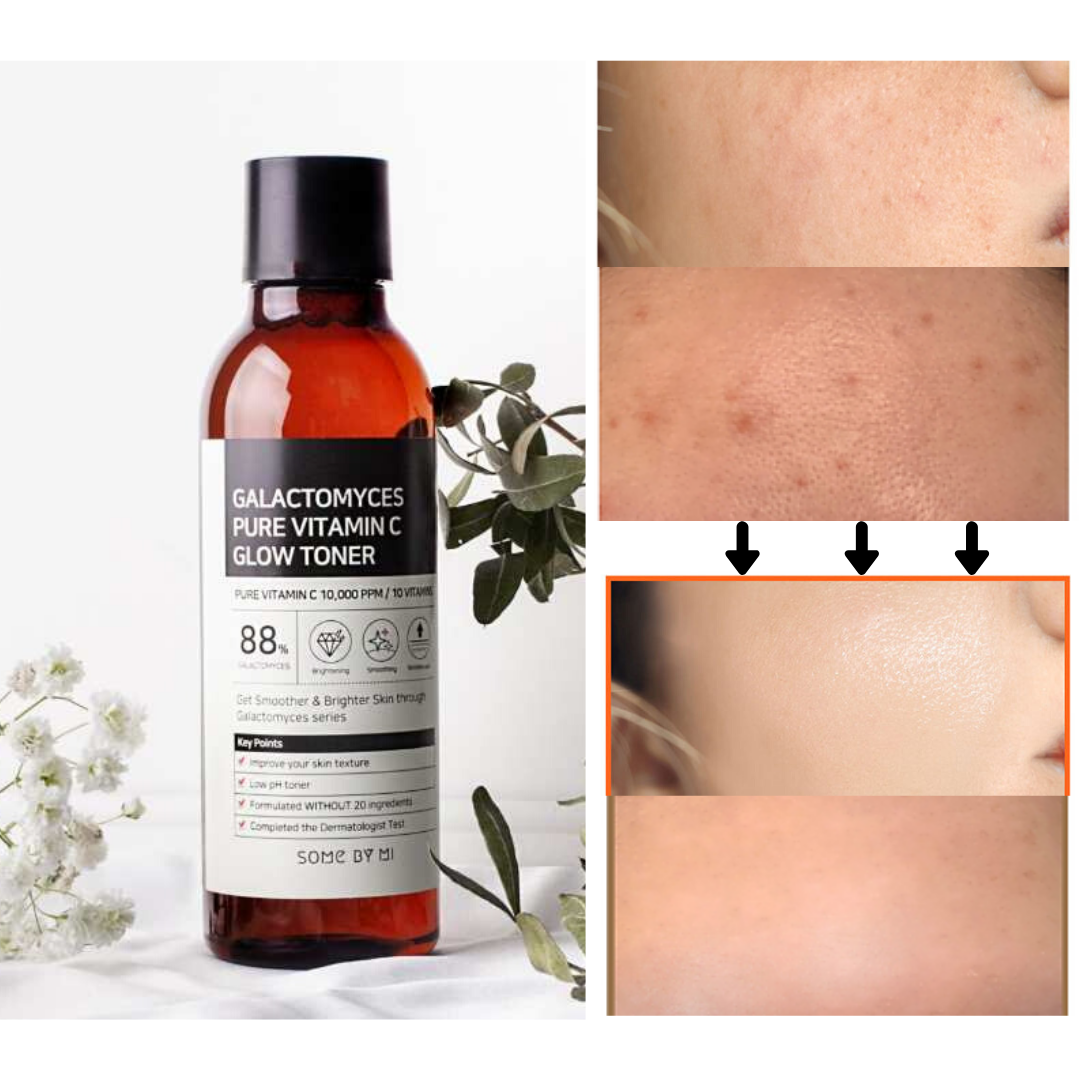 Some By Mi Galactomyces Pure Vitamin C Glow Toner