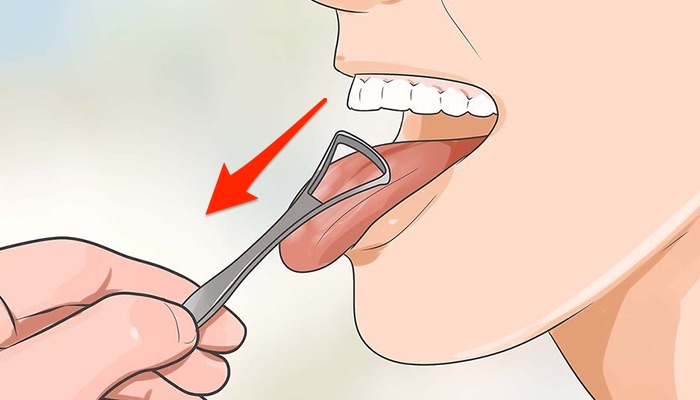 vệ sinh lưỡi