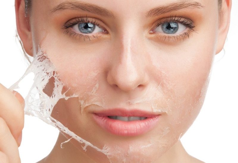 peel