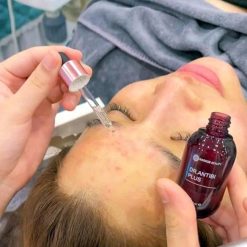 Alternative view of Serum Mụn Giảm mụn Dưỡng Ẩm Mờ thâm Thu nhỏ lỗ chân lông Dr Antibi Plus Hathor Beauty 15ml